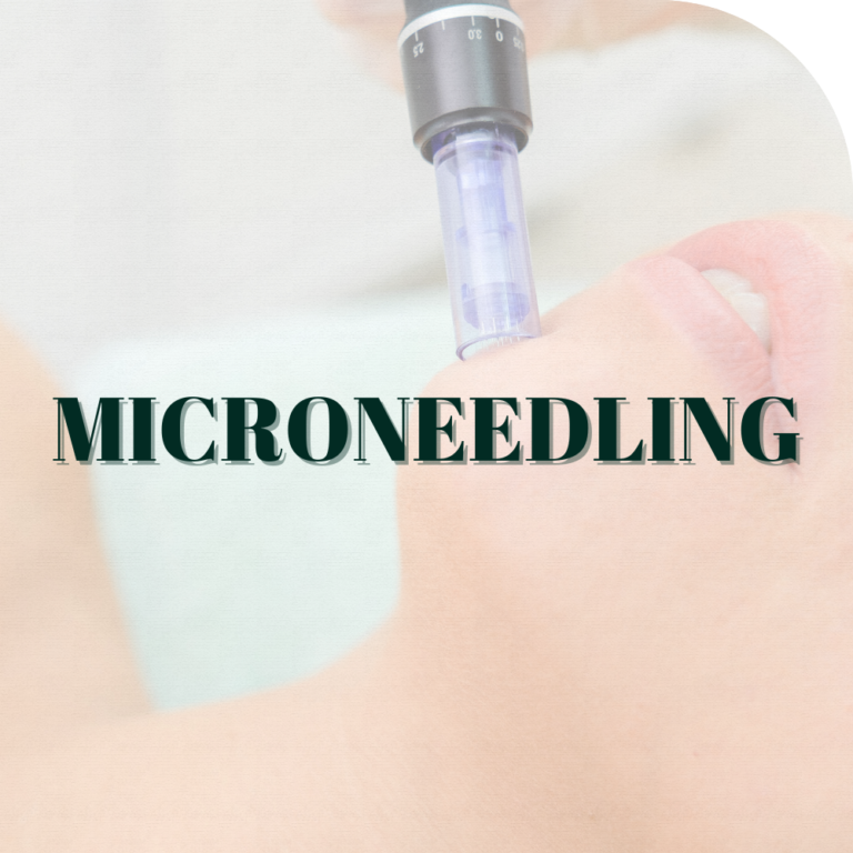 Kerry Reilly Therapy Aesthetics Microneedling